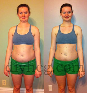Hcg Diet Getting Pregnant After