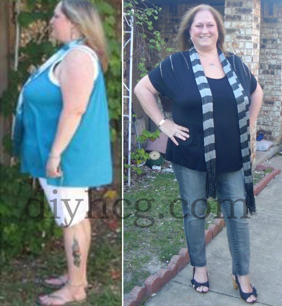 HCG Success Stories: Tammy's HCG Before and After