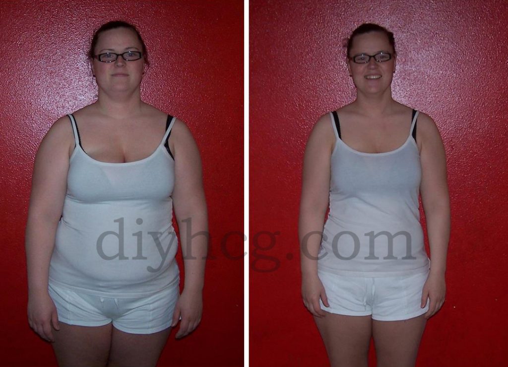 Before And After Hcg Story Using Diet Drops 9105